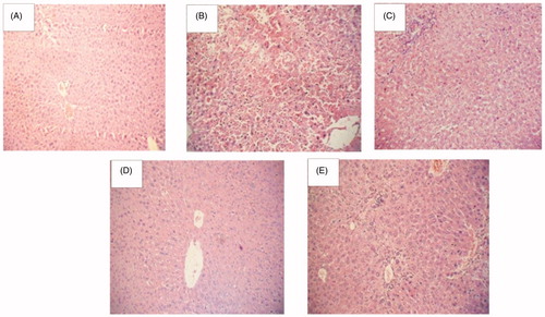 Figure 4. Histoarchitecture studies of rat liver at magnification of 100×. (A) Normal control, (B) diabetic control, (C) HEF (1000 mg/kg, p.o.), (D) glimepiride (4 mg/kg, p.o.), (E) combination (HEF extract 500 mg/kg, p.o. and Glimepiride 2 mg/kg, p.o.).