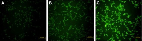 Figure 5 Confocal images of cellular uptake.Notes: (A) Free PTX/CUR, (B) PTX/CUR LPs, and (C) RGD-PTX/CUR LPs by 549 cells. Incubation time was 2 h.Abbreviations: PTX, paclitaxel; CUR, curcumin; LPs, liposomes; RGD, arginine, glycine, aspartic acid peptide.