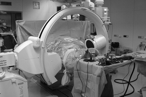 Figure 3. Intraoperative Iso-C3D® scan of the region of interest. The site was secondarily draped during the scanning procedure. Navigation tools are placed on an extra table.