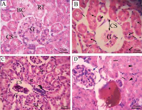 Figure 10. Photomicrographs of a transverse section of maternal kidney tissue (stained with H&E) at the 20th day of gestation. (A) Control group: normal histologic pattern of renal tissues; normal glomeruli surrounded by Bowman’s capsule and normal capsular space and normal renal tubules (RT). (B) LD group, (C,D) HD group: shredded nuclei into the tubule lumen (arrow), hypertrophy (line), and hyperplasia of the tubular epithelial lining (wavy arrow), disappearance of lumen (arrow head), inflammatory infiltration (curved arrow), fragmented tubular epithelial lining (U-shaped arrow), hemorrhage (asterus) and distortion in the epithelial lining of Bowman’s capsule (blue arrow). G = glomeruli, BC = Bowman’s capsule, CS = capsular space, and RT = renal tubules
