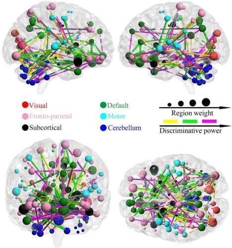 Figure 4 The distribution of consensus discriminative functional connections and their related regional weights. The ROIs are coded in different colours according to the six defined networks. Regional weights are size-coded by discriminative power in machine learning. The line colours, which were scaled with their mean discriminative performance in the LOOCV, represent the relative consensus functional connections. The 116 ROIs scaled by their weights are also displayed. The ROIs are colour-coded according to the defined networks (visual, red; frontoparietal, pink; default, green; motor, cyan; subcortical, black; and cerebellum, dark blue).