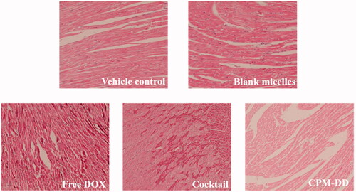 Figure 6. Evaluation of cardiotoxic effects in nude mice bearing MCF-7 cancer cells by light microscope observation (×400) of pathological change in mice left ventricles.