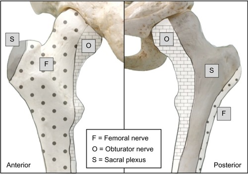 Figure 2 Osteotomal innervation of the head, neck, and proximal shaft of the femur.