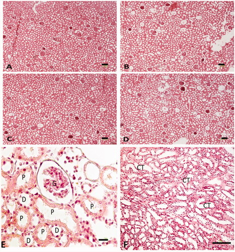 Figure 6. Photomicrograph of the testis stained with H&E (40×). (A–D) Control group, (D–F) Glomeruli (G), proximal convoluted tubule (P), distal convoluted tubule, collecting tubule (CT).