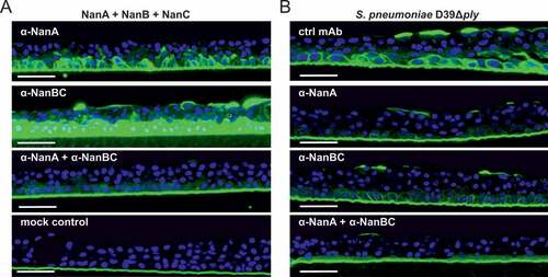 Figure 4. Multiple neuraminidases contribute to desialylation of primary human lung tissue by S. pneumoniae. Primary human lung tissue treated with an equimolar mixture of all three recombinant neuraminidases (5 nM each) ± α-neuraminidase mAbs (2 µM each) (A) or infected with S. pneumoniae D39Δply +/- α-neuraminidase mAbs (2 µM each) or control mAb (4 µM) (B) for 24 h. Desialylation was visualized by Peanut Lectin-FITC staining (green). Nuclei were stained with Hoechst dye (blue). Representative images of one experiment with biological duplicates are shown. Scale bar = 50 μm.