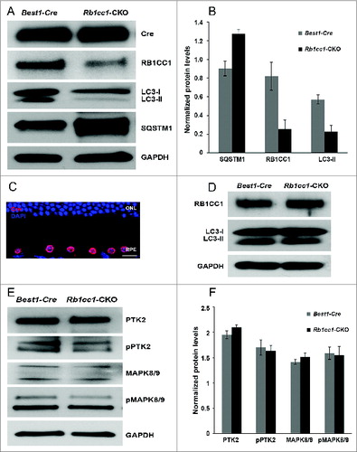 Figure 2. Conditional knockout of Rb1cc1 in the RPE results in the selective loss of autophagy activation in these cells. (A) Western blots, and (B) quantification of protein levels of RPE/choroid lysates from 2-mo-old Rb1cc1-CKO mice showed markedly reduced level of LC3-II and a significant accumulation of SQSTM1 as compared to littermate controls. Differences were significant at the P < 0.05 level. (C) Immunostaining confirmed the RPE-specific expression of Cre-recombinase (red). (D) Western blot of retina protein lysates showed normal levels of RB1CC1 and equal conversion of LC3-I to LC3-II. (E) Western blot, and (F) quantification of protein levels showed comparable amounts of phosphorylated-PTK2 (pPTK2), phosphorylated-MAPK8/JNK1-MAPK9/JNK2 (pMAPK8/9), and total PTK2 and MAPK, in the RPE from both Rb1cc1-CKO and control mice at the age of 2 mo. ONL, outer nuclear layer; RPE, retinal pigment epithelium.