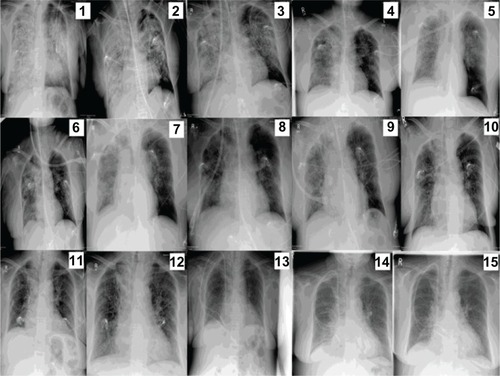 Figure 2 Sequential dates of radiographic presentation.