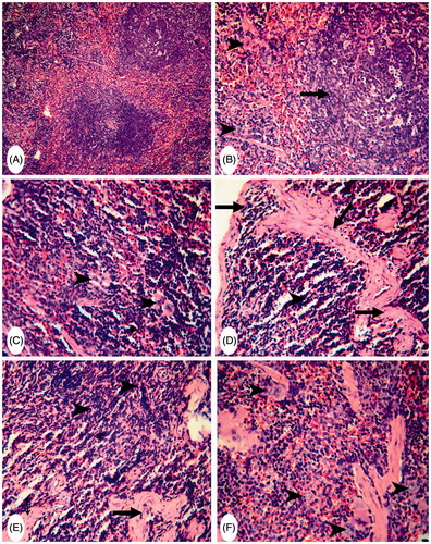 Figure 3. Representative photomicrographs of H&E-stained spleen sections. (A) Group C: normal white pulp and with numerous megakaryocytes in red pulp. Magnification 200×. (B) Group MA: mild hyperplasia in lymphoid cells of white pulp with an increase in dimensions (arrow) and a presence of megakaryocytes (arrowheads). Magnification 200×. (C) Higher magnification of (A) to show numerous megakaryocytes in red pulp (arrowheads) Magnification 400×. (D) and (E) Group (FA): thickening and hyalinization of capsule and trabeculae (arrows) – no evidence of megakaryocytes (arrowhead). Magnification 400×. Area of necrosis in splenic parenchyma and proliferation of fibroblasts (arrowheads) beside thick trabeculae (arrows). Magnification 400×. (F) Group (MA + FA): slight decreases in dimensions of white pulp and megakaryocytes (arrow-heads). Magnification 400×.