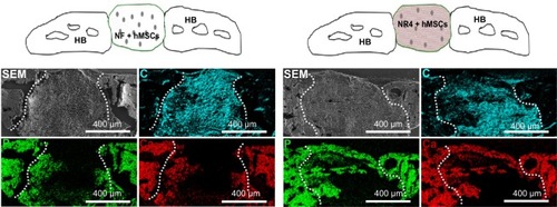 Figure 8 In vivo analysis of combined BMP-7 and hMSCs on bone tissue calcification.Notes: SEM micrographs showing the morphology and elemental composition of the NF and NR4 scaffolds seeded with hMSCs after 30 days of implantation in mouse skull. Elemental mapping of P (green), Ca (red) and C (blue) is depicted. Overall SEM visualization of the grafts is in gray. For all images, scale bars =400 μm.Abbreviations: C, carbon; Ca, calcium; HB, host bone; hMSCs, human mesenchymal stem cells; NF, not functionalized; NR4, functionalized with (chitosan/BMP-7)4 nanocontainers; P, phosphorus; SEM, scanning electron microscopy.