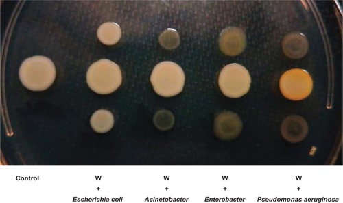 Figure 2 The effect of co-culture with different bacteria on pigment production by the Staphylococcus aureus white variant.Notes: The co-culture experiment was carried out on an LB agar plate for 48 hours between the Staphylococcus aureus white variant (W) and Escherichia coli Mg1655, Acinetobacter baumani/co 41-00-sc1-c1, Enterobacter W001, or Pseudomonas aeruginosa 6611. Only P. aeruginosa 6611 induced pigment production in the white variant (yellow colony).Abbreviation: LB, luria-Bertani.