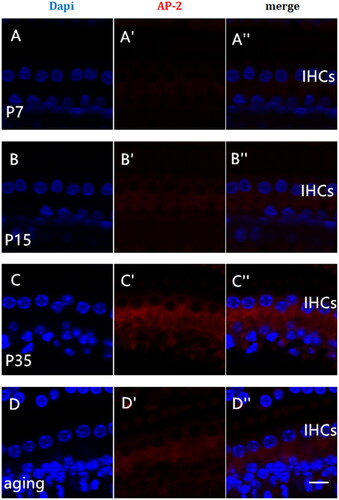 Figure 3. Expression of AP-2 protein in the cochleae of mice of different ages. The tissue was immunohistochemically stained for AP-2 (red) and examined by confocal microscopy. Nuclei were labeled with DAPI (blue). Postnatal day 7 (P7), A–A"; P15, B–B"; P35, C–C"; 16-month-old (aging), D–D". Panels A"–D" show the merged images. Scale bar = 5 µm.