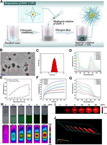 Figure 2 (A) Preparation of ZnPc 1 NPs. (B) TEM images of ZnPc 1 NPs (The red arrow in (B) indicates that ZnPc 1 NPs are a spherical nanoparticle.). (C) Size distribution of ZnPc 1 NPs. (D) UV–Vis absorption spectra of ZnPc 1 NPs. (E) The corresponding relative absorbance variations of different groups (ΔA(ZnPc 1 NPs+DPBF)-ΔA(DPBF) and ΔA(ZnPc 1+DPBF)-ΔA(DPBF)) at different irradiation times under the 690 nm laser irradiation (0.2 W/cm2). (The three asterisk indicators in € indicate an extremely significant statistical difference in the relative absorbance variations of different groups ((Δ A (ZnPc1NPs+DPBF) - Δ A (DPBF))and (Δ A (ZnPc1+DPBF) - Δ A (DPBF))) under 690 nm laser irradiation (0.2 W/cm2)). ***p < 0.001 as compared with the control. (F) Temperature elevation of ZnPc 1 NPs in dependence of power density (808 nm). (G) PA spectrum of ZnPc 1 NPs. (H) Optical graphs and IR thermal images of ZnPc 1 NPs at different concentrations(808 nm, 1.0 W/cm2). In vitro (I) 2D- or (J) 3D-PA images (render) of ZnPc 1 NPs upon excitation wavelength at 710 nm at corresponding concentrations.