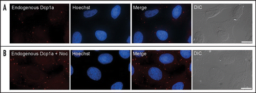 Figure 1 Endogenous PBs were stained with an anti-Dcp1a antibody (red). The nucleus was counterstained with Hoescht (blue) and cells were also imaged in DIC (grey). (A) Normal distribution of PB in human cells. (B) Disruption of the microtubule network using nocodazole (noc) led to an increase in PB numbers. (Bar, 20 µm).