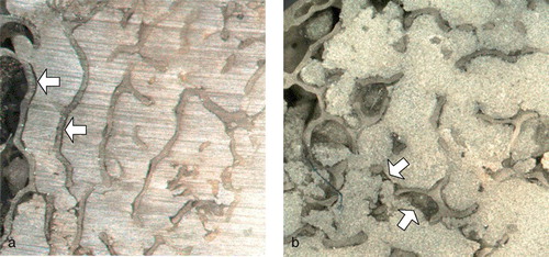 Figure 5. White light micrographs of proximal transverse sections showing interdigitated regions. (a) Standard-viscosity cement mantle. Narrow gaps can be seen between the trabeculae and the cement (arrows). These gaps were consistent with cement shrinkage. (b) Low-viscosity cement mantle. Parts of the low-viscosity mantles resembled those made with standard-viscosity cement. However, the low-viscosity mantles alone displayed extended regions where it was clear that fluid/marrow had not been displaced by the advancing cement. This resulted in gaps (arrows) that were readily distinguishable from those caused by cement shrinkage.
