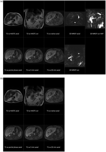 Figure 1. Gadoxetic acid-enhanced liver MRI examination of a 65-year-old male patient with PSC. Sequences included in imaging set with MRCP is depicted in (a) and without MRCP in (b). Both readers evaluated each data set in two-time points simultaneously and at two separate reading sessions.