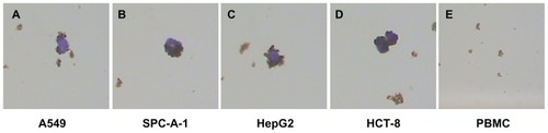 Figure 5 H&E-stained cancer cells enriched by MNPs. (A) A549 cells. (B) SPC-A-1 cells. (C) HepG2 cells. (D) HCT-8 cells. (E) No cells are enriched in the PBMC group.Note: The magnification was 100×.Abbreviations: H&E, hematoxylin and eosin; MNPs, magnetic nanoparticles; MNP-pan-ck, MNPs coupled with pan-cytokeratin antibody.