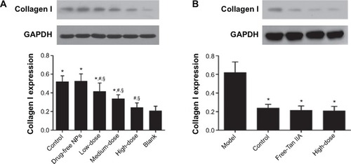 Figure 13 Effect of Tan IIA-NPs (A) and free-Tan IIA (B) on the TGF-β1 protein expression in HMrSV5 cells.Notes: High, medium and low dose groups were treated with 20, 10, and 5 μg/mL Tan IIA-NPs, respectively. And free-Tan IIA group was treated with 20 μg/mL Tan IIA. Data are expressed as mean ± standard deviation (n=3). *P<0.05 compared with blank; #P<0.05 compared with control; §P<0.05 compared with drug-free NPs.Abbreviations: NPs, nanoparticles; Tan IIA, tanshinone IIA; Tan IIA-NPs, Tan IIA liquid NPs; TGF-β1, transforming growth factor-β1.