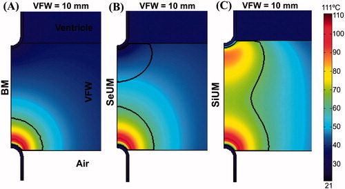 Figure 5. Temperature distributions after 120 s of RFA across the VFW (10 mm wall thickness) with the epicardial catheter surrounded by air, considering three modes of ablation: (A) bipolar mode (BM), (B) sequential unipolar mode (SeUM), and (C) simultaneous unipolar mode (SiUM). The solid black line is the thermal damage border (Ω = 1).