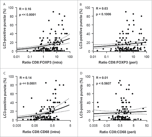 Figure 5. Correlations between LC3B puncta and CD8+:FOXP3+ and CD8+:CD68+ ratios. CD8+:FOXP3+ (A, intra; B, peri) and CD8+:CD68+ (C, intra; D, peri) ratios were determined for each patient sample and plotted against the percentage of malignant cells bearing LC3B puncta. r = pseudo correlation as indicated in the Patients and Methods section.