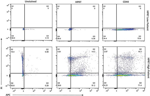 Figure 10. Evaluation of HPRT surface expression in malignant HPRT tissue. Malignant tissue was treated with PI and anti-CD45 antibodies in order to isolate the correct cell population. Upon analzying three separate patients with colon cancer, there were two patients with “HPRT low” tumors and one patient with an “HPRT High” tumor.