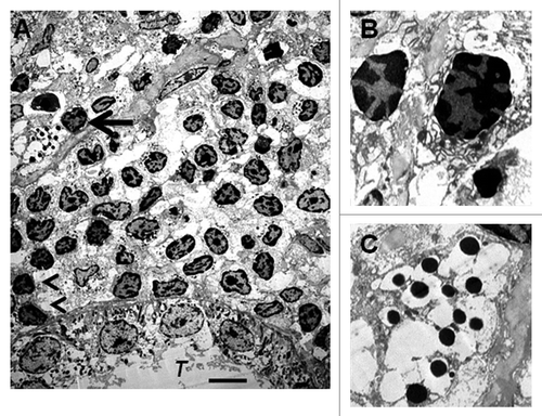 Figure 6 Electron micrographs of rat kidney following sequential transplantation of E28 pig pancreatic primordia in mesentery and implantation of porcine islets in kidney. (A) Subcapsular space. T, renal tubule; Cell containing granules with a crystalline core surrounded by a clear space is delineated by an arrow; Macrophages are delineated by arrowheads. (B) Enlargement of macrophages. (C) Enlargement of granules with a crystalline core surrounded by a clear space. Scale bar 5 um (A). Reproduced with permission from the American Society for Investigative Pathology.Citation12