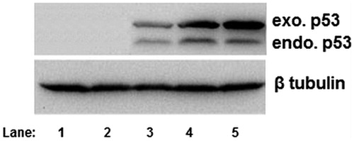 Figure 10. p53 expression by Western blot analysis using anti-mouse primary antibody p53 in NT8e cells (lane 1: negative control; lane 2: naked plasmid p53; lane 3:positive control; lane 4:PEI25:pDNA conjugate at weught ratio 8:1; lane 5: PEI25:pDNA conjugate at weught ratio 10:1).