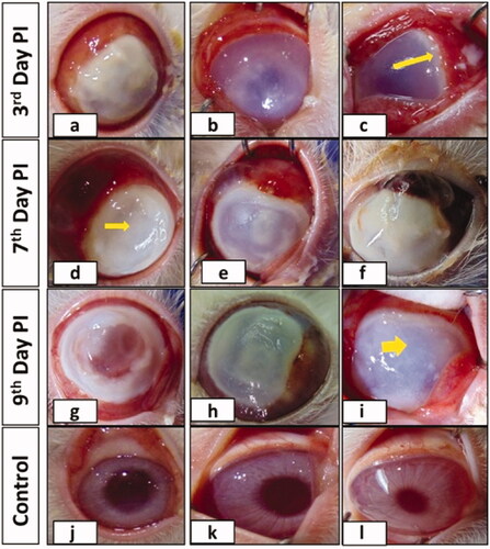 Figure 1 Clinical, pictorial representation of P. insidiosum infected (intracorneally) rabbit right eye [3rd, 7th and 9th day post infection (PI)] and uninfected left eye. Pictures a, b, c, d, e, f, g, h and i are infected right eye of rabbit (R)3, R7, R29, R9, R10, R36, R11, R12 and R30 respectively with total (short thin arrow), ring (long thin arrow) or patchy infiltrate (short thick arrow) while j, k and l are the representative pictures of uninfected control eye with normal clinical characteristics (received only PBS, pH-7.4).