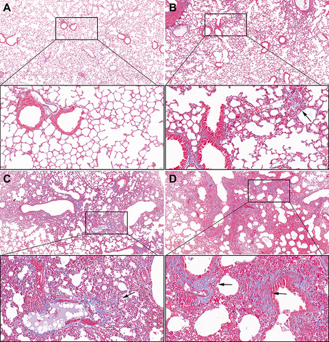Figure 3 Masson staining of lung tissue 1 month after irradiation and/or anti-PD-1 treatment in each group.