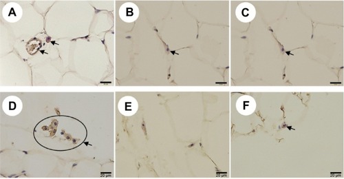 Figure 5 Immunohistochemical staining of CD68-expressing neutrophils (A–C) and F4/80-expressing macrophages (D–F) in adipose tissue of rats of all groups at week 60 with long-term treatment with or without rare sugar d-psicose.