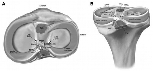 Figure 4. Pertinent anatomical relationships (right knee) as reported by Johannsen et al.7 A. Superior view. B. Posterior view. Reprinted with permission from Johannsen et al. (Citation2012). ACL: anterior cruciate ligament bundle attachments; LPRA: lateral meniscus posterior root attachment; LTE: lateral tibial eminence; MPRA: medial meniscus posterior root attachment; MTE: medial tibial eminence; PCL: posterior cruciate ligament bundle attachments; SWF: shiny white fibers of posterior horn of medial meniscus.