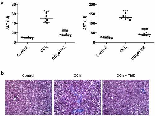 Figure 1. TMZ inhibits liver function changes and liver fibrosis in CCl4-induced mice. (a) Aminotransferase (ALT) and aminotransferase (AST) levels were measured by the kits. (b) Masson staining of tissue liver fibrosis. ***P < 0.001 vs. control; ###P < 0.001 vs. CCl4.