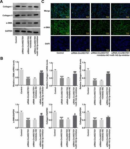 Figure 6. miR-142-3p inhibitor reverses the effect of circHECTD1 knockdown on fibrosis and TGF-β/SMAD signaling. (a) Collagen I, collagen II, and α-SMA mRNA expression detected by western blot, and (b) RT-qPCR. (c) α-SMA expression detected by immunofluorescence. ***P < 0.001 versus Control; #P < 0.05, ##P < 0.01, ###P < 0.001 versus siRNA-circHECTD1 + inhibitor-NC; n = 3.