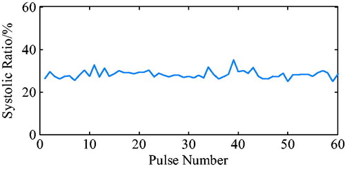 Figure 12. Heart systolic ratio by combining electrocardiogram and arterial pressure.