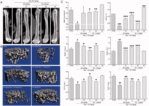 Figure 2. Effects of AU on the femoral bone morphology and the concentrations of osteoporosis (OP)-related factors in OP mice. (A) Micro-computed tomography images of the femurs of OP mice. (B) Three-dimensionally reconstructed images of trabecular bone in the femurs of OP mice. (C) Analysis of OP parameters (BMD, BV/TV, BS/BV, Tb.Sp, Tb.Th and Tb.N). Data are expressed as the means ± SEMs (n = 6) and were analysed using a one-way ANOVA. #p < 0.05, ##p < 0.01 and ###p < 0.001 versus control mice; *p < 0.05, **p < 0.01 and ***p < 0.001 versus OP mice. CTRL: control; Dex: dexamethasone; E2: oestradiol; AU: aucubin.