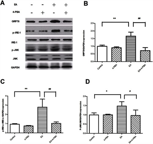 Figure 5 EA exposure activated markers of ER stress pathways in human adipocytes. (A) Representative GRP78, p-IRE1-α, p-JNK Western blots; quantification of the Western blot membranes for (B) GRP78; (C) p-IRE1-α; (D) p-JNK. Results are representative averages of at least three independent experiments and displayed as means ± SD. Compared to control group *P<0.05, **P<0.01; compared to EA-treated group, #P<0.05, ##P<0.01.