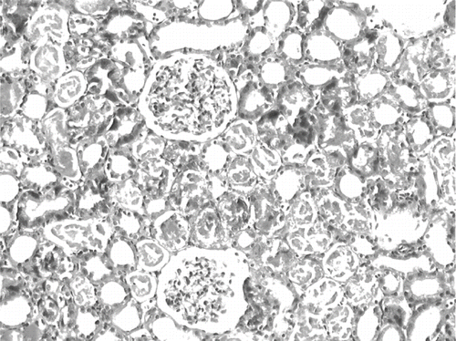 Figure 6. Kidney section of a glycerol + vitamin C-treated rat (ARF-VC group). The level of tubuler necrosis and cast formation is decreased compared with the ARF group (H&E, × 100).