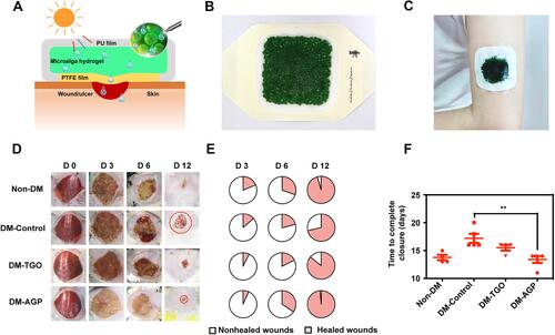 Figure 5 Microalgae-gel patch for chronic wound healing. (A) Schematic illustration of the microalgae-gel patch for promoting chronic wound healing via the process of light-triggered oxygen production. (B) Image of the microalgae-gel patch. (C) Application of microalgae-gel patches. (D) Images of the wound healing process in different groups. Red circles mark the wound areas in the diabetic mouse (DM)-control and DM-alga-gel patch (AGP) groups on day 12. (E) Schematic diagram of the wound healing proportion. (F) Summary of wound healing time. **P < 0.01. The two groups are compared with one-way Analysis of Variance (ANOVA). From Chen H, Cheng Y, Tian J, et al. Dissolved oxygen from microalgae-gel patch promotes chronic wound healing in diabetes. Sci Adv. 2020;6(20):eaba4311. © The Authors, some rights reserved; exclusive licensee AAAS. Distributed under a CCBY-NC 4.0 license https://creativecommons.org/licenses/by/4.0/”. Reprinted with permission from AAAS.Citation28