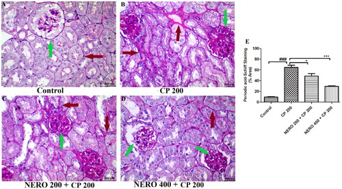 Figure 8. Showing the effect of nerolidol 200 and 400 mg/kg, p.o against cyclophosphamide-induced histopathological aberrations (PAS staining) in the renal tissue, and figure E represents the semi-quantitative analysis of PAS staining. One-way ANOVA, i.e., tukey’s multiple comparison test was used for statistical analysis. (PAS staining, 400 × magnification).
