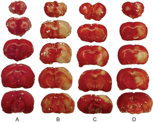 Figure 2.  Brain slices were stained by 1% TTC solution. (A) Sham-operated group. (B) Model group. (C to D) Rats were dosed with oleanolic acid at 25 or 12.5 mg/kg for four days before MCAO respectively.