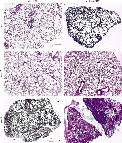 Figure 1.  Histological comparison of different pulmonary regions with (left column) and without (right column) recruitment breath manoeuvre (RBM). Zones 1–3 are presented from the top of the picture to the bottom. Note the slightly over-distended areas in zone 1 in both treatment groups and the difference in zone 3, with less aerated areas in lung specimens from a pig not treated with RBM.