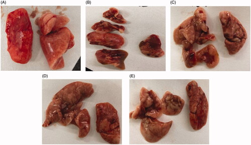 Figure 7. The appearance of lung tissue in the sham-operation group (A), model group (B), low-dose group (C), middle-dose group (D), and high-dose group (E) on day 28.