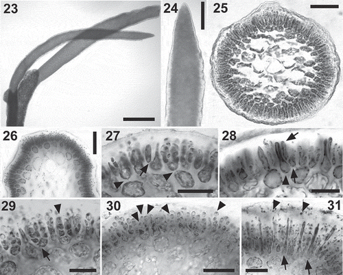 Figs 23–31. Calliblepharis hypneoides. Male reproductive structures. 23, 24. Surface view of spermatangial sorus surrounding upper branchlets. 25, 26. Cross-section of immature (Fig. 25) and mature (Fig. 26) surface spermatangial sori. 27. Primordium of spermatangial filaments after the first oblique division (arrow) and spermatangial filaments with a remnant basal rounded cell (arrowheads showing their pit connections to inner cortical cells). 28. Spermatangial primordium (arrowhead) after the first division leading to the formation of spermatangial filaments from the point of the first separated cell (arrows). 29. Spermatangial chains three or four cells long, which are simple (arrowhead) or branched (arrow). 30. Spermatangial filaments with one to three mature spermatia that have differentiated apical nuclei and basal vacuoles at the tip of each filament (arrowheads). 31. Sorus with mature spermatia and released spermatia with a central nucleus (arrowheads) and elongated cells (arrows), which correspond to primordia that have not cut off spermatangial filaments. Scale bars = 600 µm (Fig. 23), 70 µm (Figs 24, 26), 50 µm (Fig. 25) and 30 µm (Figs 27–31).