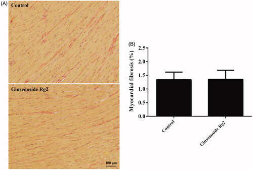 Figure 2. Effect of ginsenoside Rg2 on myocardial fibrosis in normal rats. Data are presented as the mean ± SD (n = 3). A indicates representative photomicrographs of Sirius red staining of the hearts. B indicates bar graph of myocardial fibrosis.