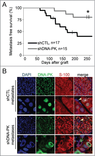 Figure 2. DNA-PKcs depletion impairs the formation of melanoma metastases. We grafted 4×106 cells of shCTL- and shDNA-PK-treated SK28 cells into Nude mice and then surgically removed the resulting primary tumors when they attained a volume of 1500 mm3. Animals were monitored for 258 d after grafting, to check for the occurrence of metastases in the proximal lymph node. (A) Lymph-node metastasis-free survival curves for shCTL and shDNA-PK tumors (*P=0 .018, Kaplan-Meier test). (B) Representative images of double-immunostaining for DNA-PK (green) and human melanoma marker S-100 (red) in shCTL and shDNA-PK metastases. Yellow arrows indicate infiltrating mouse cells, white arrowheads indicate human DNA-PK-positive cells and green arrowheads indicate human DNA-PK-deficient cells. DNA was stained with DAPI (blue). Scale bar = 20 μm.