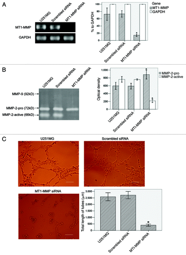 Figure 5 (See p. 984). The influence of MT1-MMP inhibition on VM formation in U251MG. (A) RT-PCR analysis of MT1-MMP and GAPDH. GAPDH served as an internal control. MT1-MMP transcript was evaluated by OD and compared. The OD of GAPDH was considered 100% relative to MT1-MMP in each group. (B) Gelatin zymography analysis of MMP-2 and MMP-9 activities in different groups. MMPs activities were evaluated by OD and compared. (C) VM tube formation assay in different groups of U251MG. U251MG cells with different treatments were seeded onto the surface of wells of a 24-well plate coated with Matrigel at a concentration of 2.5 × 105 cells/ml for 24 h and photographed. Scale bar = 200 μm. Total length of VM tubes per field in 100 × scope was compared between groups. *p < 0.01 compared with untreated U251MG.