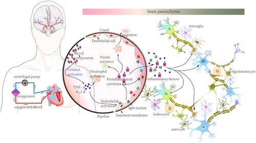 Figure 1. Systemic inflammatory response syndrome (SIRS) in extracorporeal membrane oxygenation (ECMO). The schematic diagram of major equipment used in ECMO therapy is shown on the left. The centrifugal pump and oxygenator are the important components of ECMO. Drained venous blood (blue arrows) is oxygenated in the oxygenator. Thereafter, oxygenated blood (red arrows) returns for arterial circulation. As blood components and biomaterials interact, the activated contact system promotes the production of inflammatory factors and cytokines and the activation of platelets, endothelium, and neutrophils. A mass of inflammatory factors, cytokines, and activated neutrophils migrate into the brain parenchyma with increase in permeability and structural damage of the blood-brain barrier (BBB). Thereafter, under SIRS conditions, neuronal plasticity of the CNS due to heterogenous substances or activated neuroglia cells in the brain parenchyma account for the development of neurocognitive complications after ECMO.