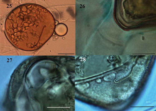Fig. 25-28. Fig. 25 Zygospore with three-layered wall, mesospore finely punctate and brown colour (LM); Fig. 26. Detail of mesospore finely punctate (LM); Fig. 27. Mature zygospore showing the ‘riss-linie’ sigmoid (LM); Fig. 28. Detail of mesospore finely punctate and ‘riss-linie’ sigmoid (LM). Fig. 25. Scale bar = 20 μm. Figs 26-28 Scale bar = 10 μm