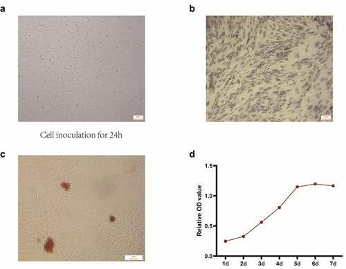 Figure 2. Isolation and culture of osteoblasts. (a) Osteoblast morphology observed under white light. (b) Identification of osteoblast differentiation using ALP staining. (c) Determination of osteogenic differentiation by alizarin red staining. (d) Determination of cell proliferation activity by MTT. Scale bar: 100 μm.