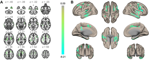 Figure 3 ALFF difference maps (A) and (B). Cool color represents decreased ALFF brain area in numbness patients, and colorbar represents T value.