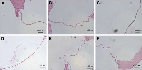 Figure 7 Safety evaluation of various inhibitors using paraffin sections of RWM. Control group (A), colchicine (B), MβCD (C), chlorpromazine hydrochloride (D), MON (E), and BFA (F).Abbreviations: RWM, round window membrane; MβCD, methyl-β-cyclodextrin; MON, monensin sodium salt; BFA, brefeldin A.